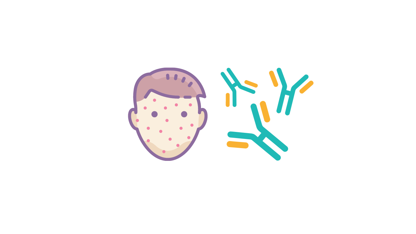 Varicella (Chickenpox) Immunity Test